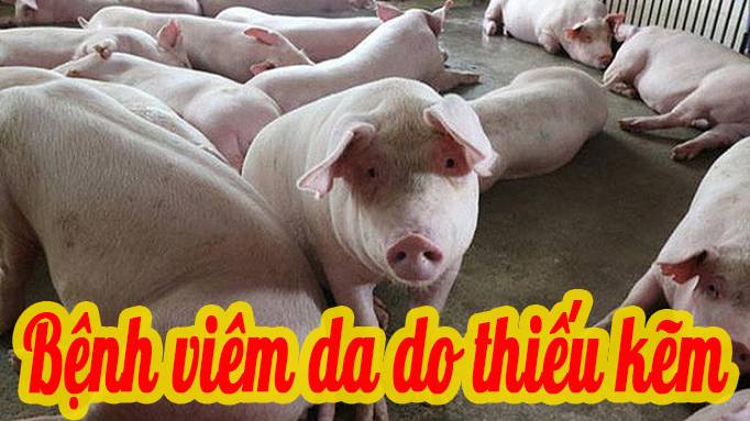 Bệnh viêm da do thiếu kẽm