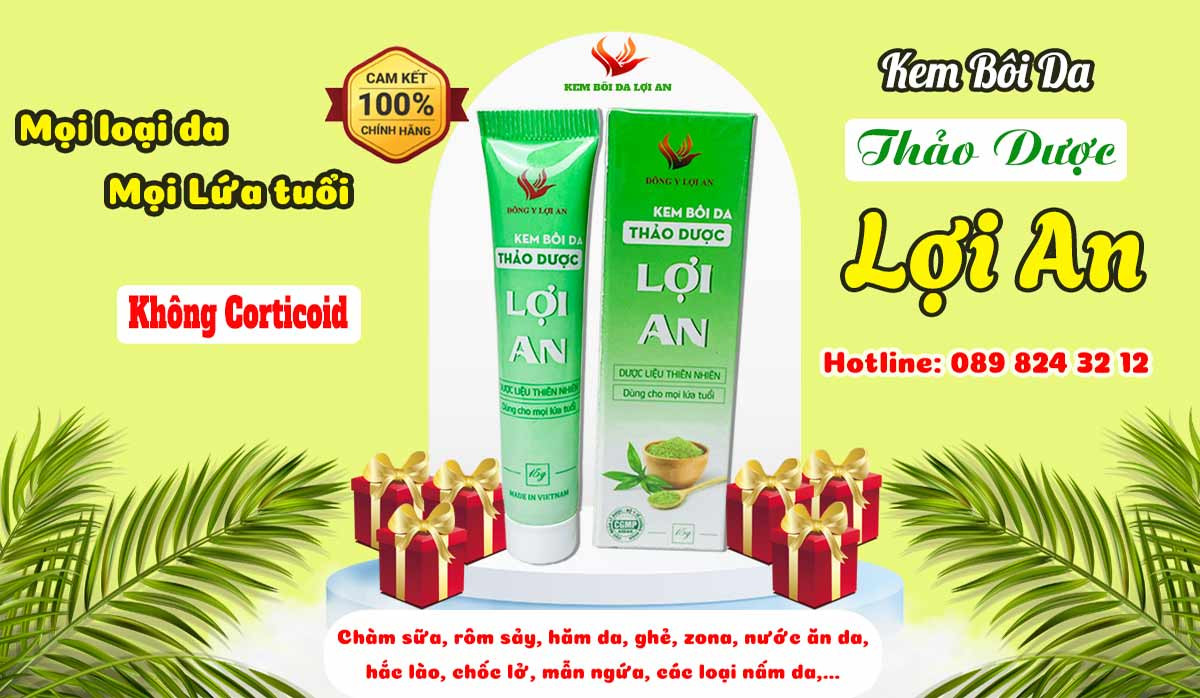 Kem Bôi Da Lợi an