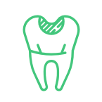 
Root Canal
